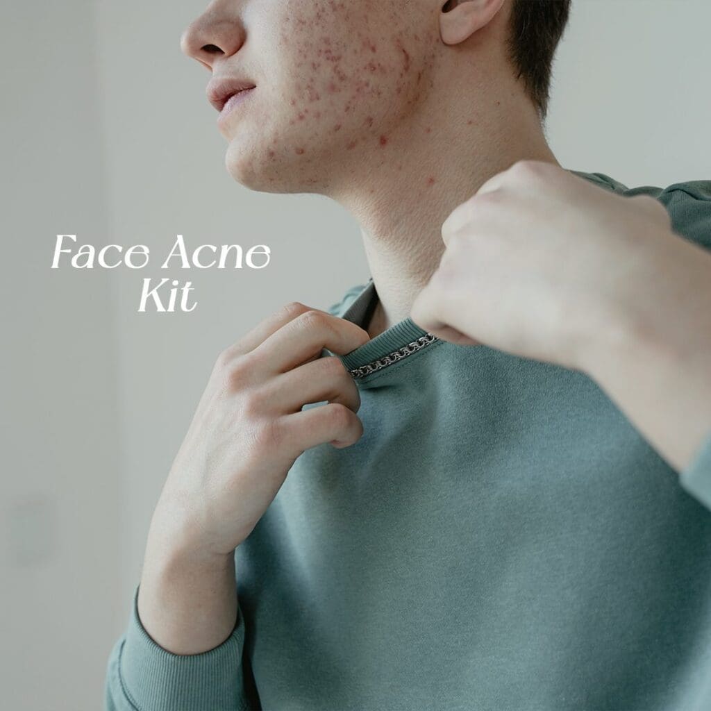 Face-Acne